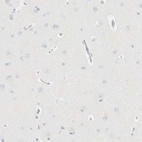 Immunohistochemical staining of human cerebral cortex shows low expression as expected.