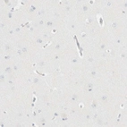 Immunohistochemical staining of human cerebral cortex shows low expression as expected.