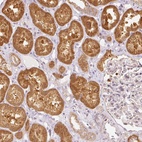 Anti-SNAPC5 Antibody