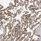 Immunohistochemical staining of human lung shows strong membranous positivity in pneumocytes.