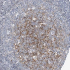 Immunohistochemical staining of human tonsil shows moderate membranous positivity in germinal center cells.