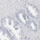 Immunohistochemical staining of human prostate shows no positivity in glandular cells as expected.