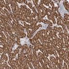 Anti-RBM12B Antibody