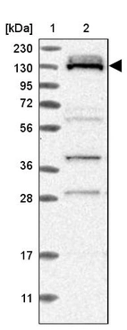 Lane 1: Marker [kDa] 230, 130, 95, 72, 56, 36, 28, 17, 11_br/_Lane 2: Human cell line RT-4