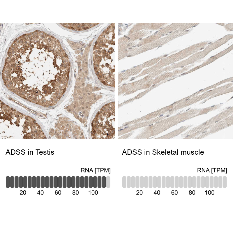 Anti-ADSS Antibody