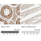 Anti-ADSS Antibody