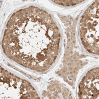 Immunohistochemical staining of human testis shows moderate cytoplasmic positivity in cells in seminiferous ducts.
