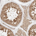 Immunohistochemical staining of human testis shows moderate cytoplasmic positivity in cells in seminiferous ducts.