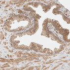 Immunohistochemical staining of human prostate shows moderate cytoplasmic and membranous positivity in glandular cells.