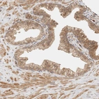 Immunohistochemical staining of human prostate shows moderate cytoplasmic and membranous positivity in glandular cells.