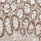 Immunohistochemical staining of human rectum shows moderate to strong cytoplasmic positivity in glandular cells.