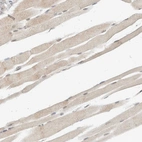 Immunohistochemical staining of human skeletal muscle shows weak cytoplasmic positivity in myocytes.
