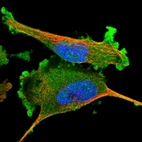 Immunofluorescent staining of human cell line U-251 MG shows localization to plasma membrane & cytosol.