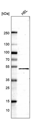 Anti-DSCC1 Antibody