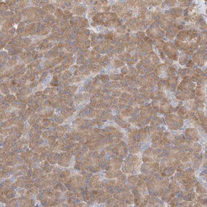 Anti-C16orf58 Antibody
