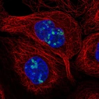 Immunofluorescent staining of human cell line A-431 shows localization to nucleoli.