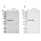 Western blot analysis using Anti-ERAL1 antibody HPA024423 (A) shows similar pattern to independent antibody HPA021425 (B).