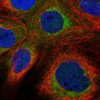 Immunofluorescent staining of human cell line A-431 shows localization to cytosol & mitochondria.