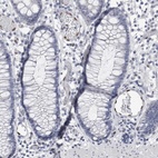 Anti-IL33 Antibody