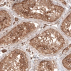 Immunohistochemical staining of human testis shows strong cytoplasmic positivity in cells in seminiferous ducts.