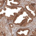 Immunohistochemical staining of human prostate shows strong cytoplasmic positivity in glandular cells.