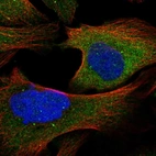 Immunofluorescent staining of human cell line U-2 OS shows localization to cytosol.