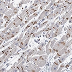 Anti-TMEM102 Antibody