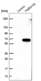 Western blot analysis in control (vector only transfected HEK293T lysate) and TMEM102 over-expression lysate (Co-expressed with a C-terminal myc-DDK tag (~3.1 kDa) in mammalian HEK293T cells, LY405901).