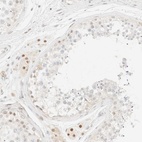 Anti-TSR1 Antibody