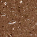 Immunohistochemical staining of human cerebral cortex shows high expression.