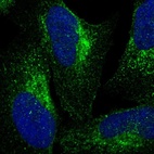 Anti-VPS53 Antibody