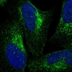 Immunofluorescent staining of human cell line U-2 OS shows localization to cytosol & the Golgi apparatus.