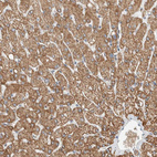 Anti-SLFN12L Antibody