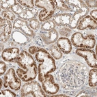 Immunohistochemical staining of human kidney shows strong cytoplasmic positivity in cells in tubules.