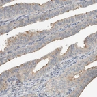 Immunohistochemical staining of human fallopian tube shows moderate cytoplasmic positivity in glandular cells.