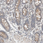 Immunohistochemical staining of human gastrointestinal shows moderate cytoplasmic positivity in glandular cells.