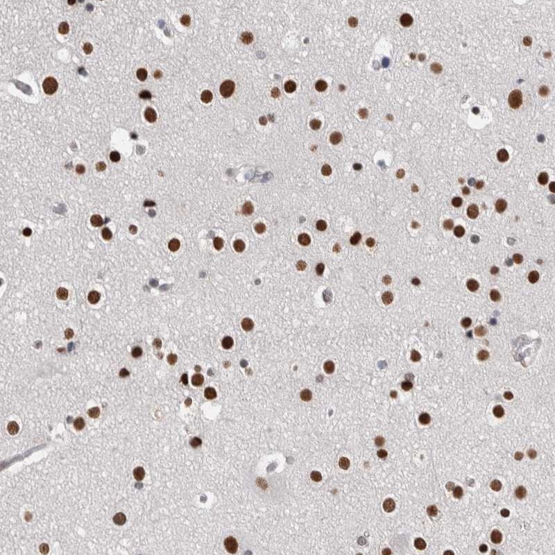 Anti-ZBTB49 Antibody