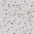 Anti-ZBTB49 Antibody