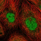 Immunofluorescent staining of human cell line A-431 shows localization to nucleoplasm & cytosol.