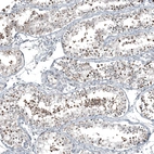 Anti-C1orf112 Antibody