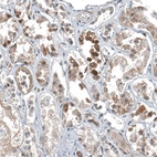 Immunohistochemical staining of human kidney shows moderate nuclear and cytoplasmic positivity in cells in tubules.