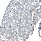 Immunohistochemical staining of human liver shows no nuclear positivity in hepatocytes.