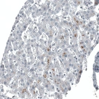 Immunohistochemical staining of human liver shows no nuclear positivity in hepatocytes.