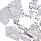 Immunohistochemical staining of human skeletal muscle shows no nuclear positivity in myocytes as expected.