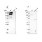 Western blot analysis using Anti-C1orf112 antibody HPA024451 (A) shows similar pattern to independent antibody HPA023778 (B).