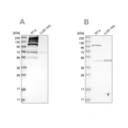Western blot analysis using Anti-C1orf112 antibody HPA024451 (A) shows similar pattern to independent antibody HPA023778 (B).