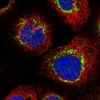 Immunofluorescent staining of human cell line A-431 shows localization to mitochondria.