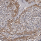 Immunohistochemical staining of human tonsil shows moderate cytoplasmic positivity in squamous epithelial cells.