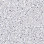 Immunohistochemical staining of human liver shows no positivity in hepatocytes as expected.