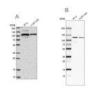Western blot analysis using Anti-BICD2 antibody HPA024452 (A) shows similar pattern to independent antibody HPA023013 (B).